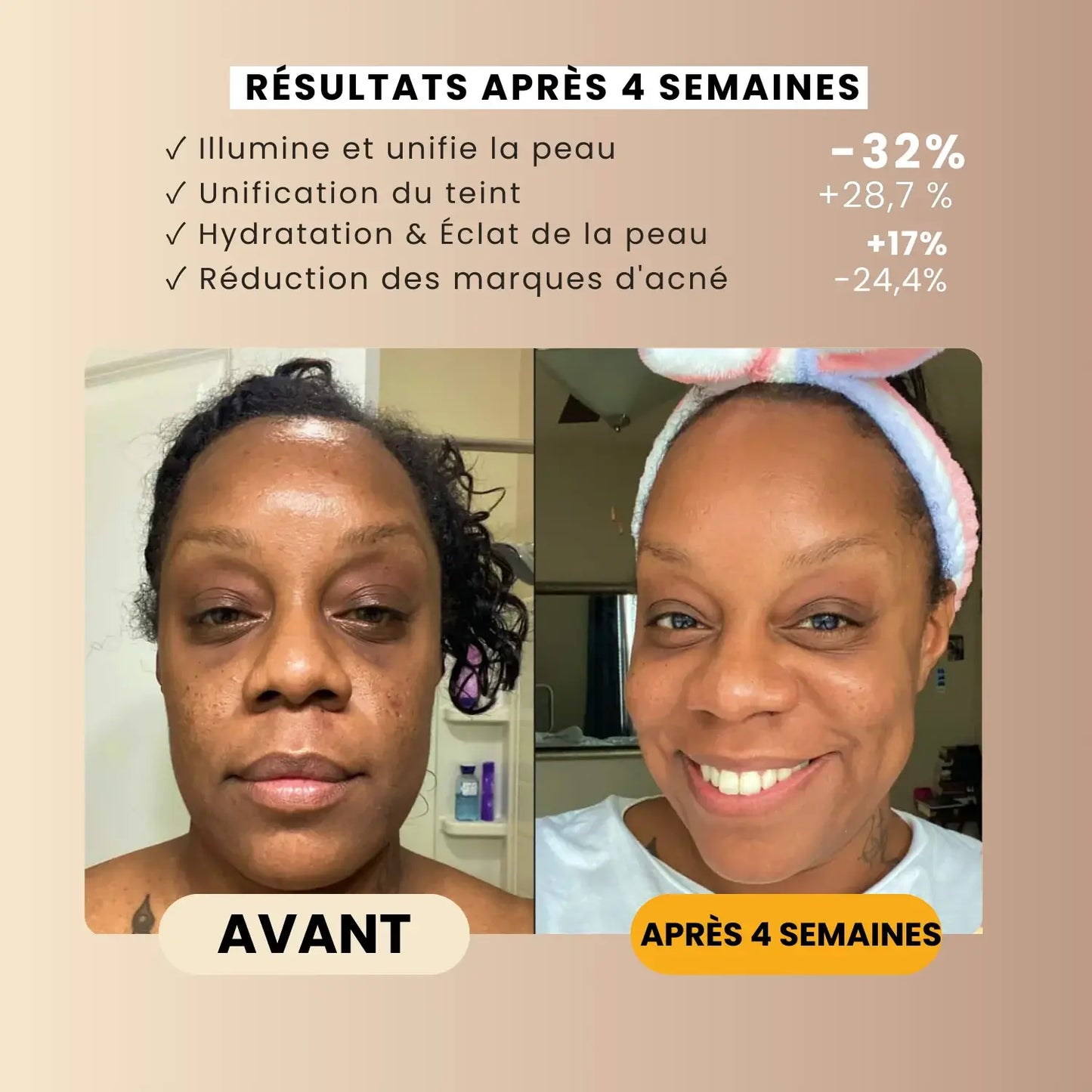 Savon Anti-Taches au Curcuma