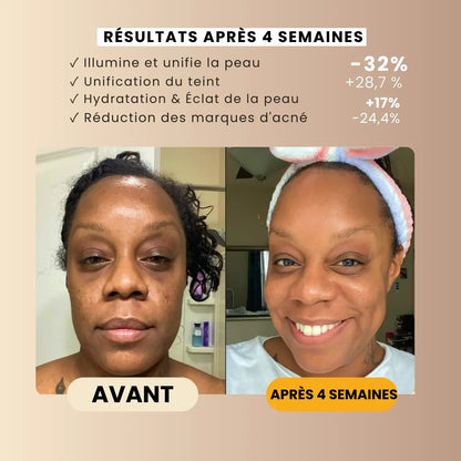 Savon Anti-Taches au Curcuma